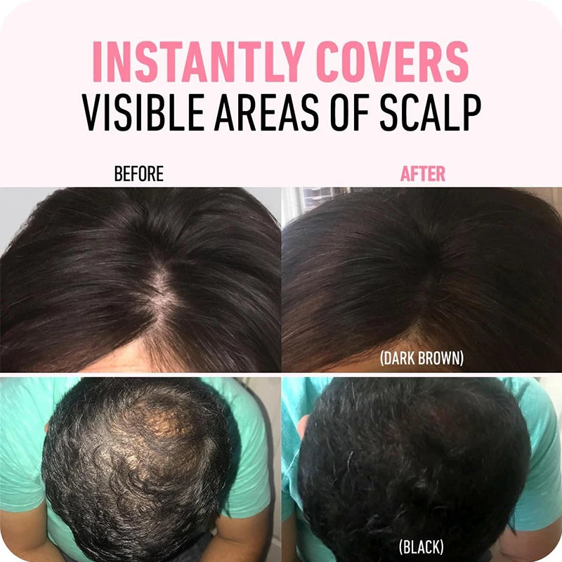 Hairline Concealer Powder for Thinning Hair - Instant Root Touch-Up for Men and Women